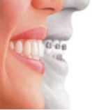 Principali difetti ortodontici